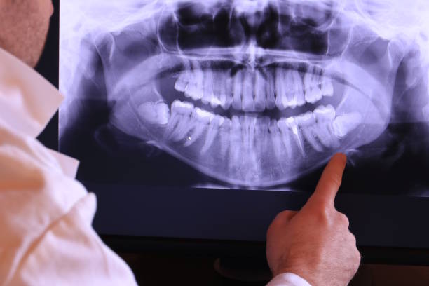 Best Emergency Tooth Extraction  in Forest City, PA