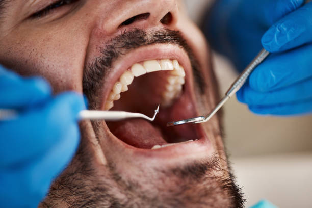 Best Emergency Gum Pain Relief  in Forest City, PA